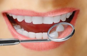 Are your teeth dark, gapped or cracked? Richmond porcelain veneers from Westhampton Dentistry repair those annoying smile defects. 