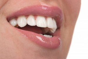 woman smiling showing perfect teeth