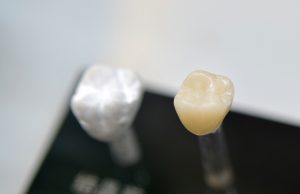 Two models of dental crowns